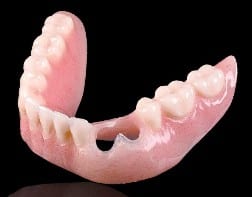 cu-si partial denture