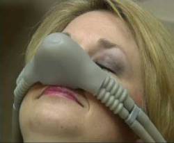 A woman wearing a nosepiece in order to administer nitrous oxide. 