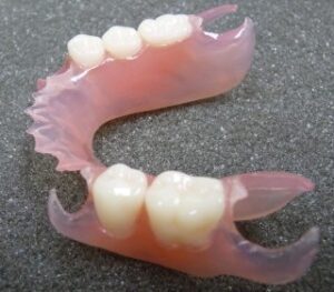 Valplast partial denture
